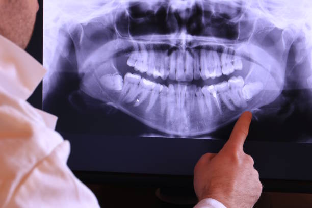 Best Emergency Dental Care for Trauma or Injury in Red Cloud, NE