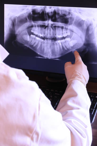 Best Emergency Tooth Extraction in Red Cloud, NE