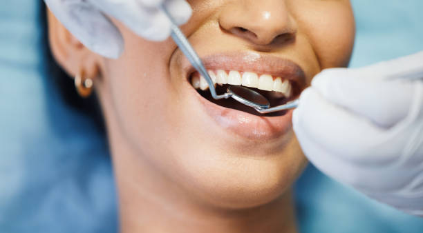 Best Emergency Tooth Extraction in Red Cloud, NE